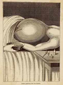 Drain: REMOVAL OF FLUID