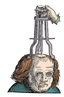 Trephination: Removing Bone with Trochlea Bipes, 1527