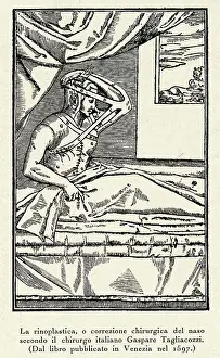 Correction: RHINOPLASTY/C16TH