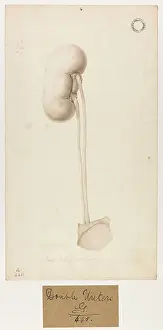 Kidney: Right Kidney with Two Ureters