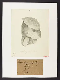 Lung: Right Lung with Four Lobes