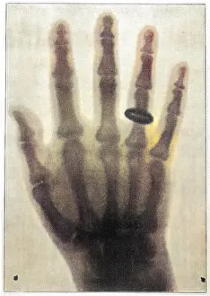 Roentgen system x-ray