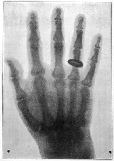 Voller: Roentgen system x-ray