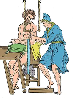 Knees: Roman Devices for Setting Fractures
