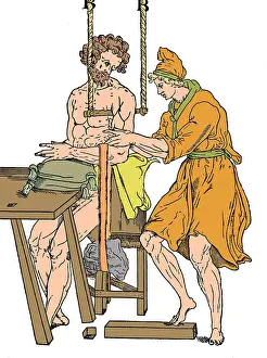 Knees: Roman Devices for Setting Fractures