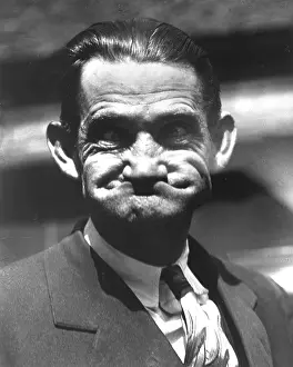 Puckering: Rubber Face