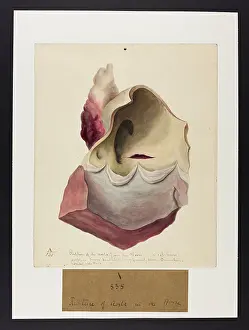 1831: Rupture of the Aorta (Horse)