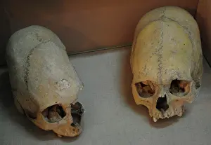 Deformed: Sarmatians. Deformed human skulls. Probably dated in the 3rd