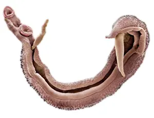 Scanning: Schistosoma nasale, bloodfluke