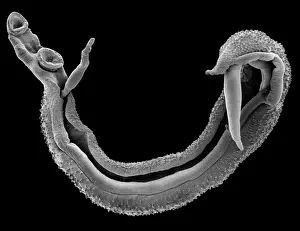 Fluke: Schistosoma spp. blood fluke
