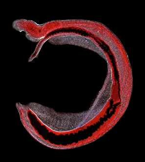Fluke: Schistosoma spp. blood fluke