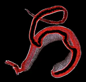 Fluke: Schistosoma spp. blood flukes