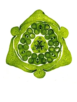 Micrograph: Section of Lily Bud, Early Photomicrograph