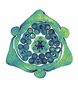 Micrograph: Section of Lily Bud, Early Photomicrograph
