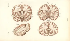 Leveille: Sections through the brain