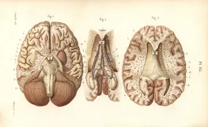 Gland: Sections through the brain and pineal gland