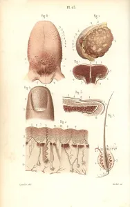Leveille: Sections of the breast, tongue, skin and finger