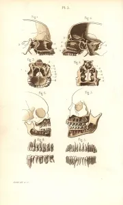 Corbie: Sections of skull, nasal cavity, jaw and teeth
