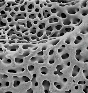 Starfish: SEM of echinoderm steroem