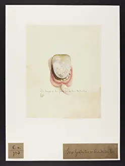 Ucl Library Services Digital Collections: Sero-gastritis