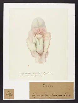 Ucl Library Services Digital Collections: Serum and Coagulable Lymph