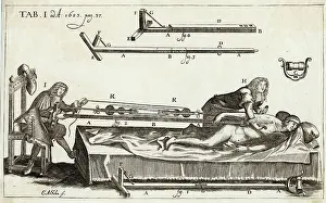 Surgeons: SETTING A BONE 1682