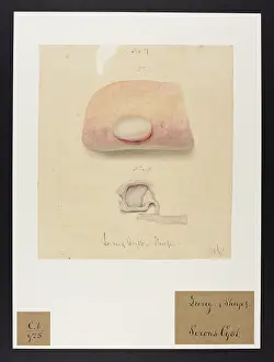 Plantes: Sheep: Serous Cyst