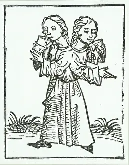 Reported: Siamese or conjoined twins. Children joined at