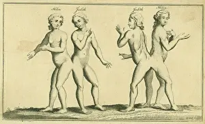 Siamese: Siamese or conjoined twins. Helen and Judith