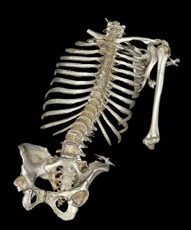 Forensic: Skeletal Reconstruction