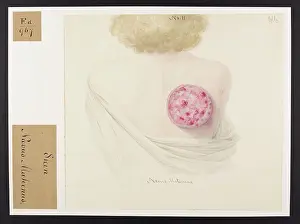 1837: Skin: Navus Maternus