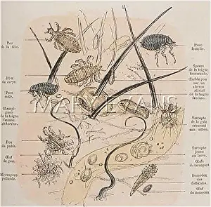 Parasites: SKIN PARASITES/1881