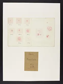 Ucl Library Services Digital Collections: Skin : Vaccinia