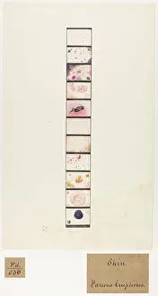 Blank: Skin: Various Eruptions