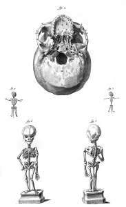 Skeletons: SKULL & FOETUS SKELETONS