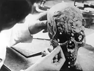 Estimate: SKULL RECONSTRUCTION