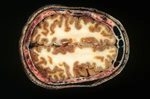 Slice: Slice of Human Brain