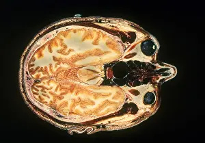 Slice: Slice of Human Brain