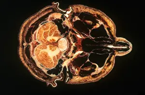 Slice: Slice of Human Brain