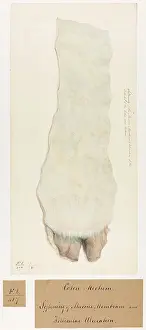 Colon: Softening of the Mucous Membrane and Ulceration
