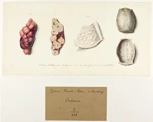 Plantes: Spleen. Pleura. Bone. Tubercle. Monkey