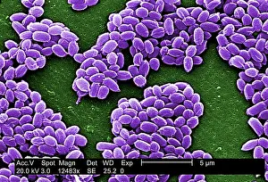 Anthrax: Spores from an anthrax bacteria. These spores ?