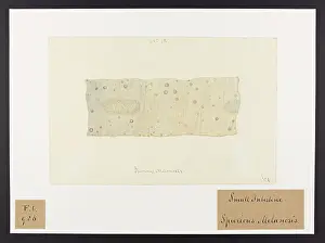 1831: Spurious Melanosis: Small Intestine