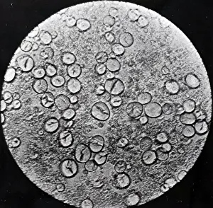 Inheritance: Starch grains of cross between round and wrinkled