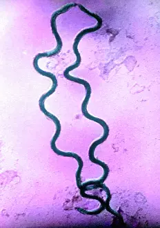 Sore: STD, Treponema pallidum Bacteria, SEM