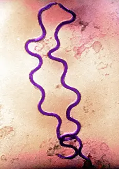 Sore: STD, Treponema pallidum Bacteria, SEM
