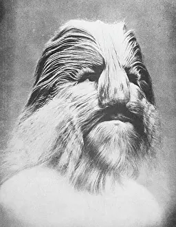 Hypertrichosis: Stephan Bibrowski - Lionel the Lion-faced Man