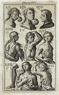 Tumour: SUAREZ de RIBERA, Francisco (s.XVIII). Spanish