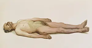 Forensic: Suicide by Hanging, 1898