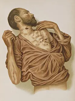 Angles: Suicide Through Stabbing, 1898
